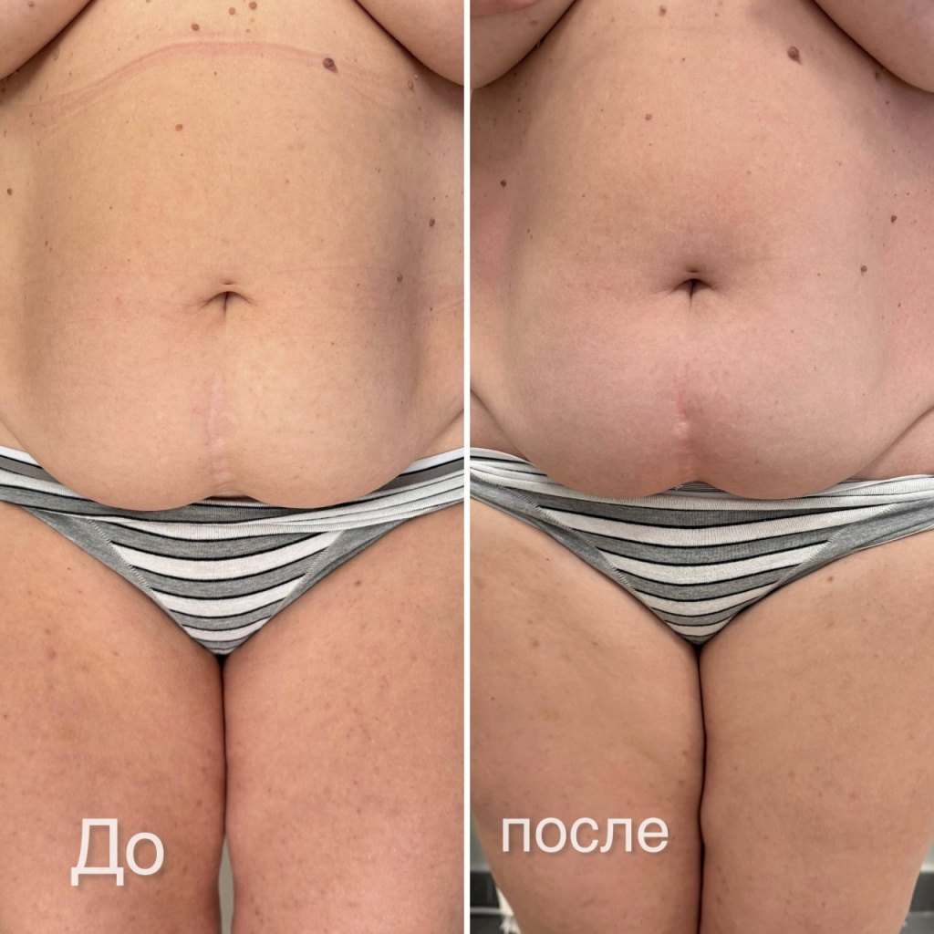 2026-02-23 20.42.48.jpg